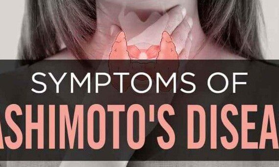 Hashimoto's Hypothyroidism
