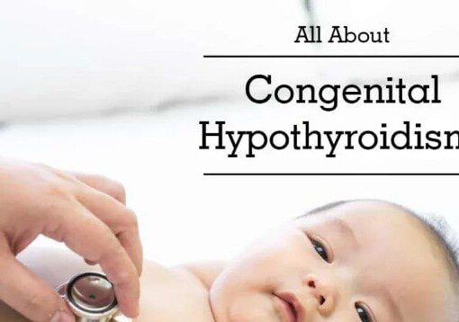 Congenital Hypothyroidism
