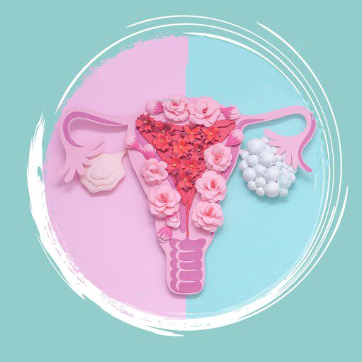 Ovarian Cysts And Fertility