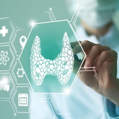 Range for TSH in Hypothyroidism?