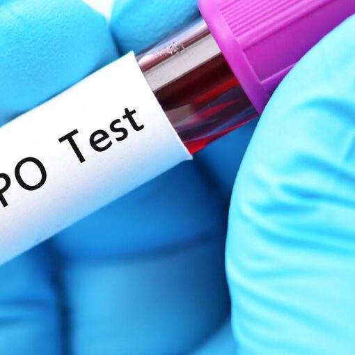 Thyroperoxidase (TPO) is an enzyme that plays a crucial role in thyroid hormone production.